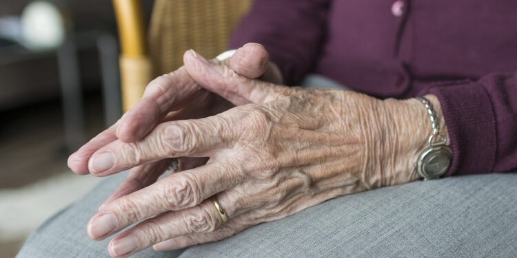 These are the reasons that hands look older